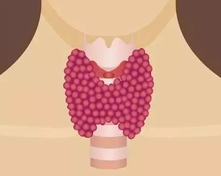 得了甲减会影响智商吗,原发性甲减影响寿命吗