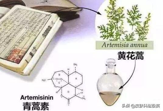 屠呦呦研究的青蒿素与红斑狼疮,屠呦呦青蒿素对红斑狼疮最新研究