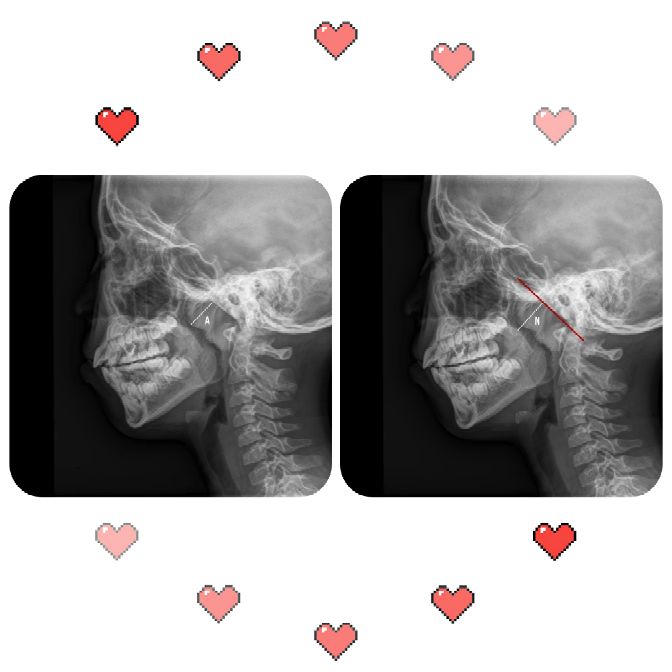 瘦的人睡觉打呼噜是什么原因,十四岁睡觉打呼噜是什么原因