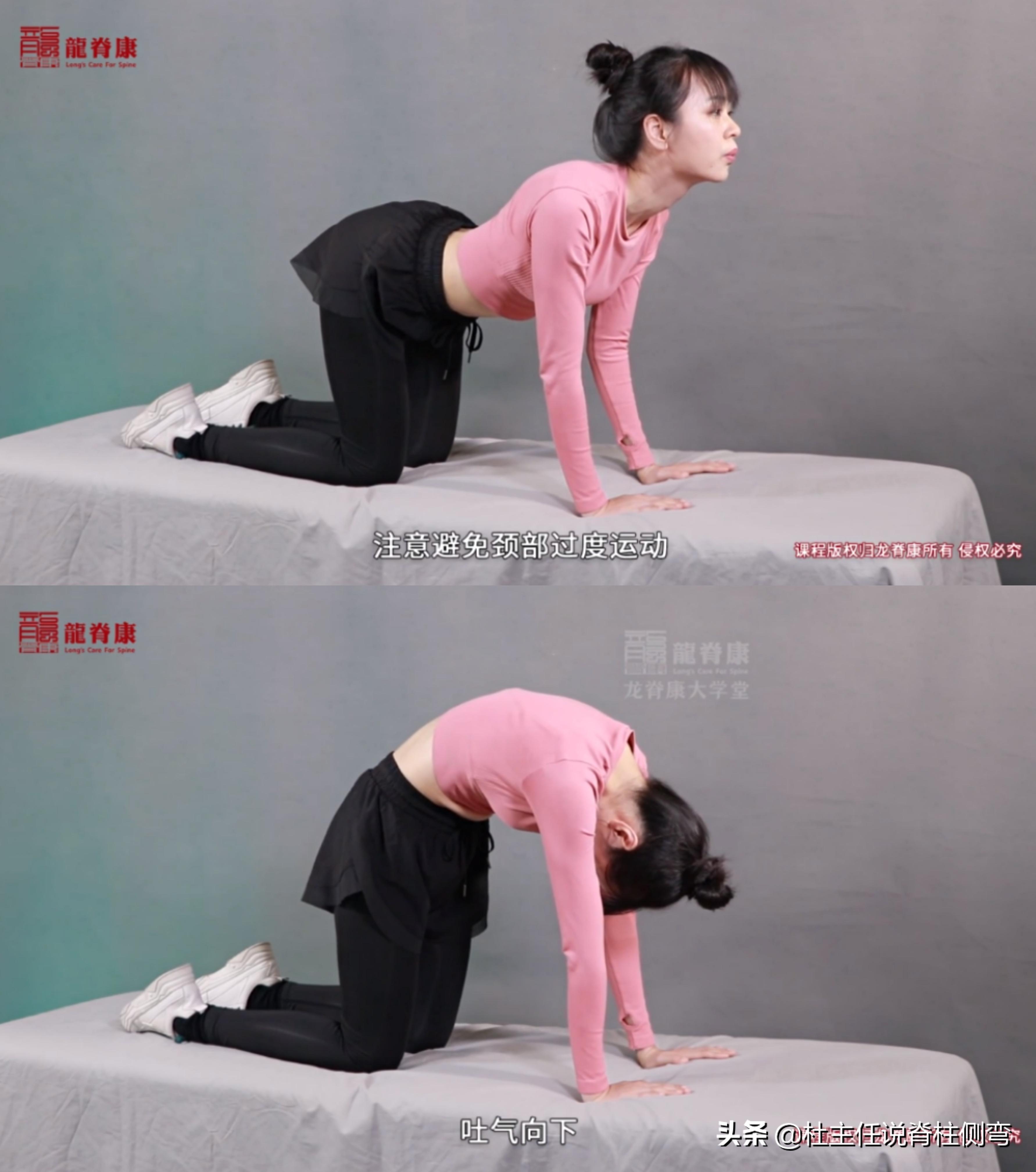 长短腿造成脊柱侧弯怎么治疗,脊柱侧弯长短腿怎么锻炼矫正视频