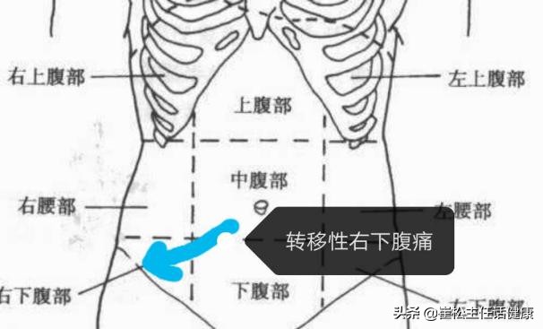 疫情有腹痛症状吗,有没有疫情期间肚子疼