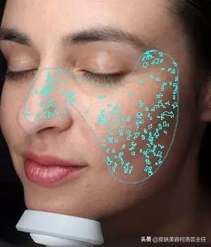 visia皮肤检测是什么原理,visia皮肤检测值多少是正常的