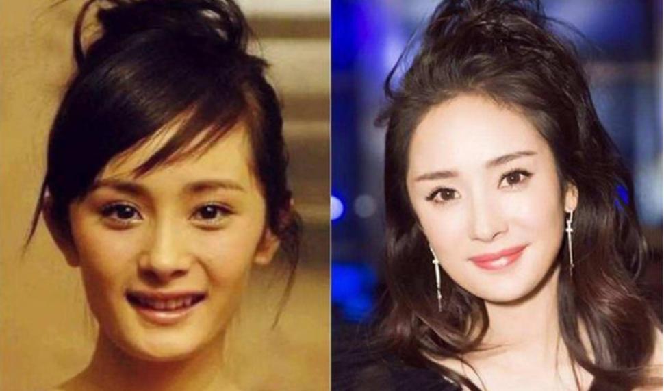 太阳穴凹陷自体脂肪填充怎么样,太阳穴凹陷显凶吗