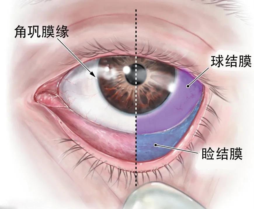 眼睛总感觉磨得慌还流泪,眼睛总觉得磨得慌怎么回事