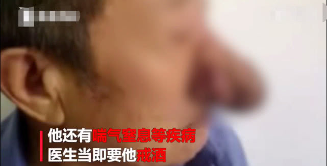 62岁大爷酗酒40年喝成河马脖,78岁老大爷喝酒