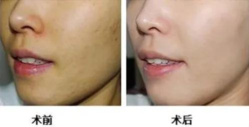 肌肤百“斑”刁难?四维瓷肌帮你终结