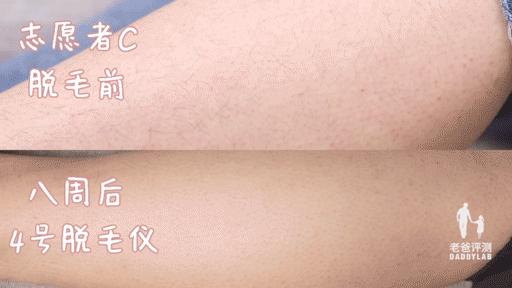 最真实的脱毛仪,bequeen脱毛仪实测