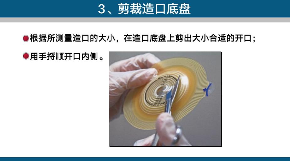 造口手术后多久复查一次,造口复查检查什么