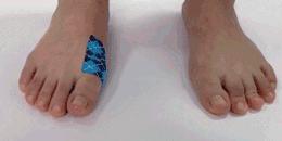 长时间运动起水泡？预防水泡，这个神器适合你