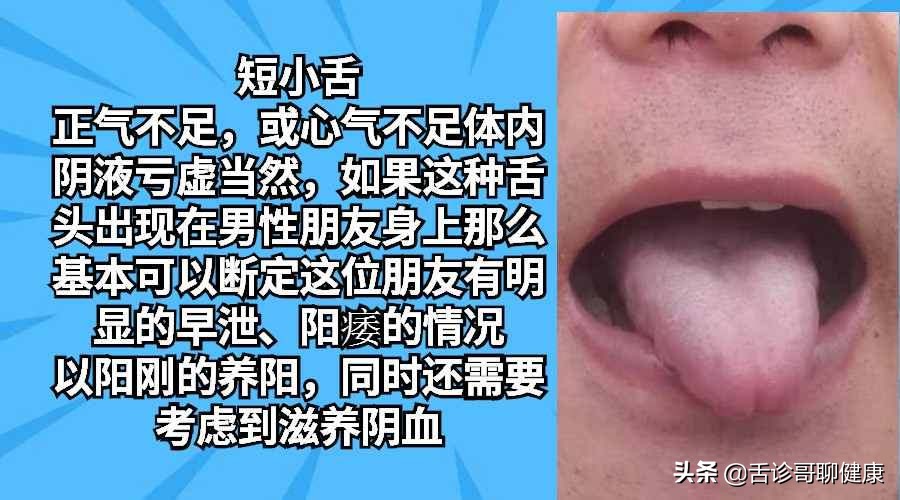 舌诊哥聊血瘀,舌诊哥聊健康痰湿