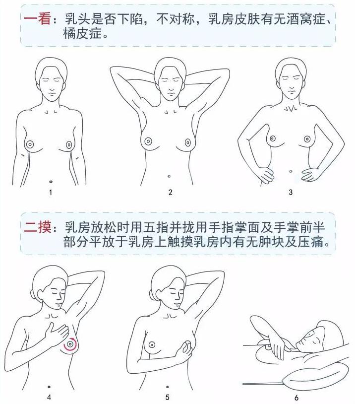 说说早期癌能不能彻底治愈,幸福癌治愈案例