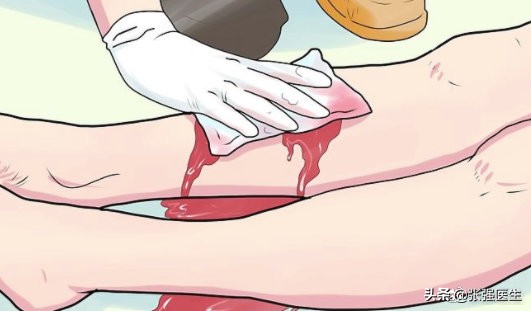 胃静脉曲张破裂前有什么征兆,老人静脉曲张严重怎么治疗最好