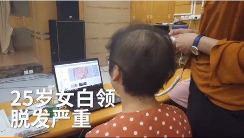 25岁女性脱发,女30岁脱发严重什么原因