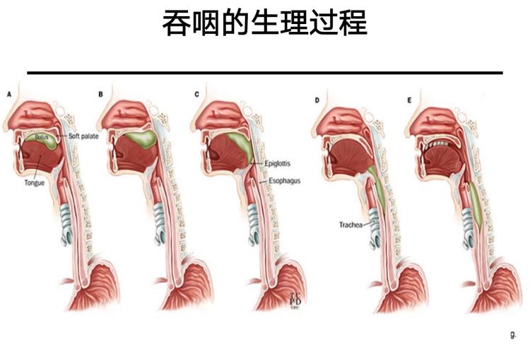 吞咽障碍有什么推拿手法,实用吞咽障碍手法训练技巧
