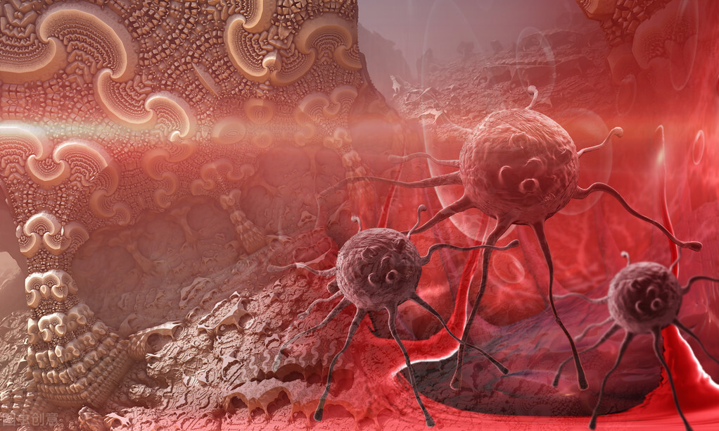 有乳腺癌遗传易感基因怎么办,哪些因素会导致乳腺癌的发生