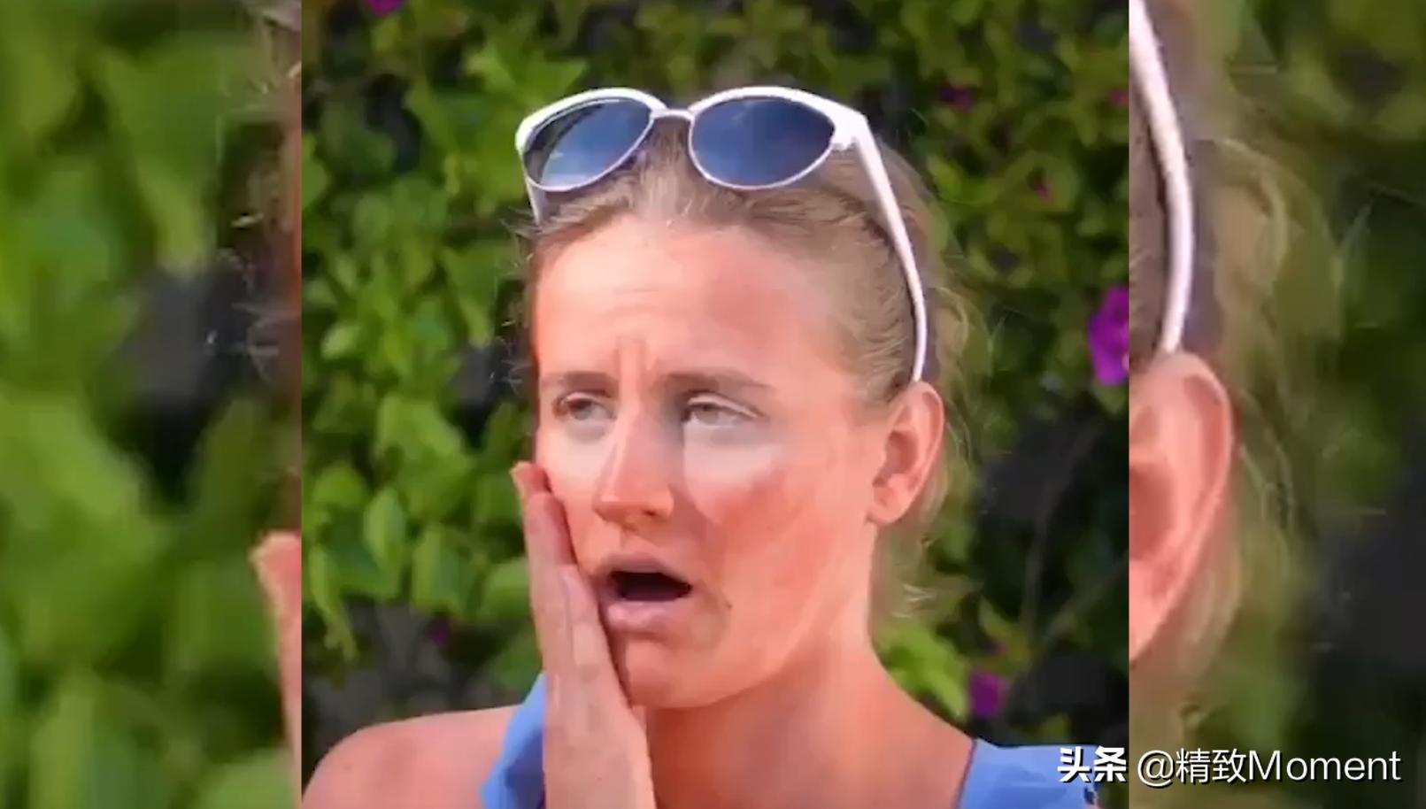 脚晒伤了发红发烫怎么快速修复,脚晒伤留下的疤怎么办