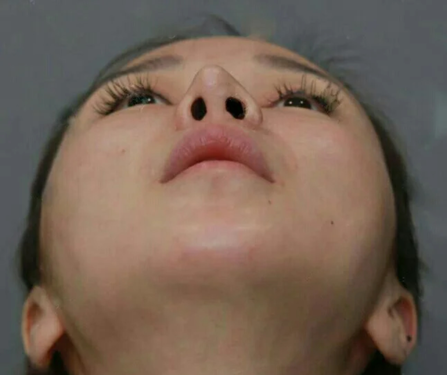 塌鼻梁蒜头鼻就一定丑吗,高鼻梁的蒜头鼻还能拯救吗