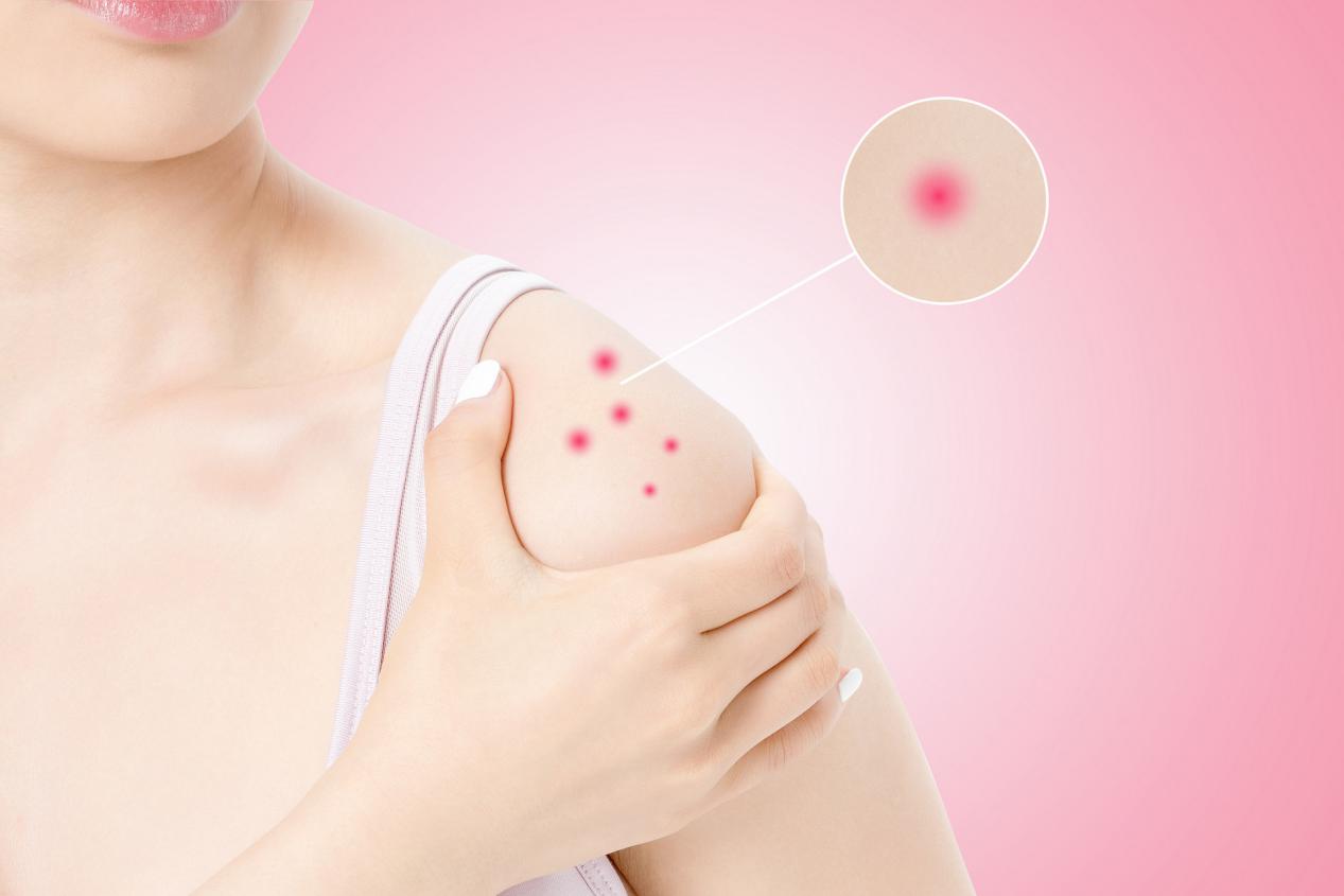 氨糖并非骨科神药,氨糖不是神药看专家怎么说