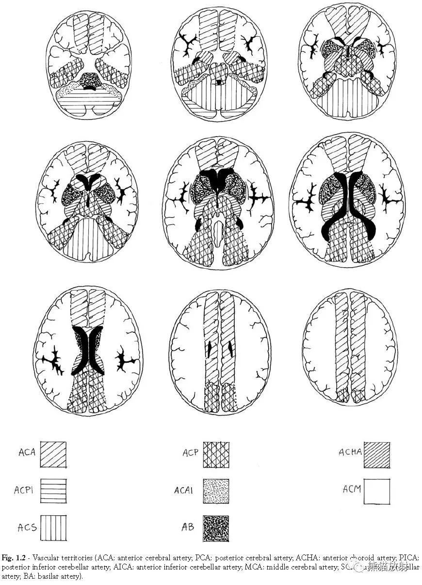 各部位脑梗死ct影像讲解,脑梗死ct影像最简单的是什么表现