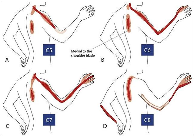 手麻木病症,手部麻木症