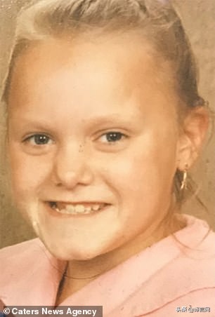 天生阴道缺失的女子使用直肠人造阴道口有望生育子女！