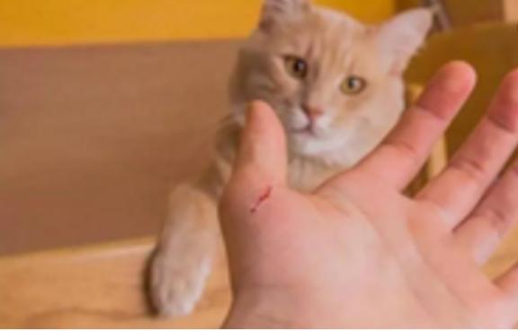 动物咬伤要及时就医,有关动物咬伤的急救知识