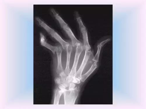 卵巢早衰来势汹汹？这5点是早衰“信号灯”，女性快自查