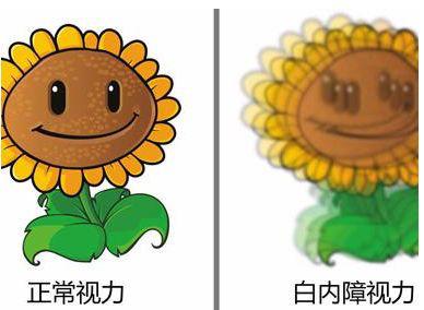 白内障爱眼日做手术免费吗,爱眼日治疗白内障哪里免费