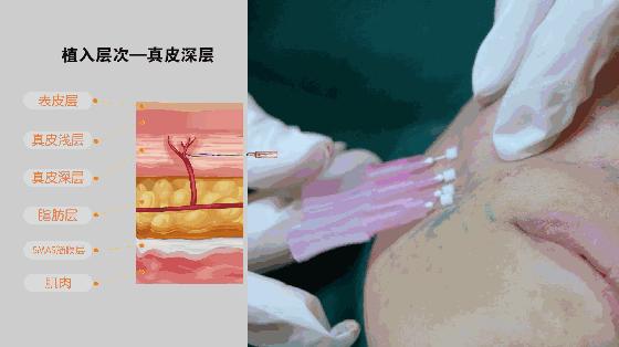 国字脸怎么瘦脸教你变成巴掌小脸,脸小有什么办法