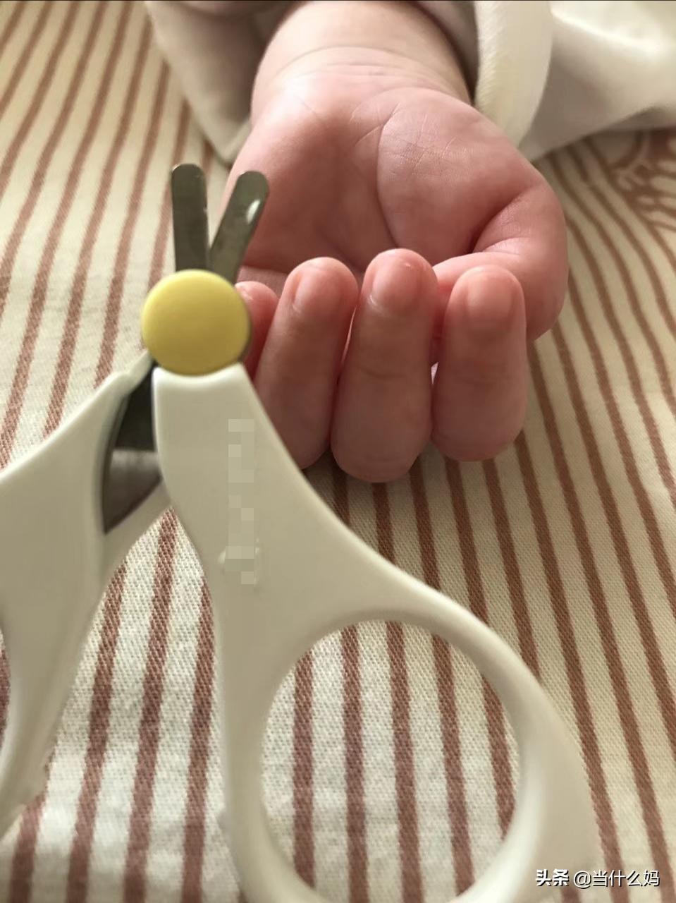 给小宝宝剪指甲剪到手了,你敢把手指甲剪掉吗