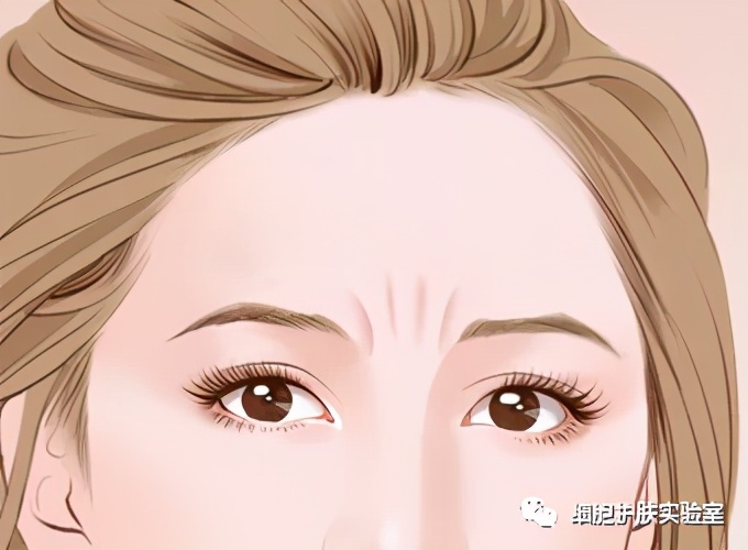 修复眉间纹最好的方法,额头皱纹眉间纹