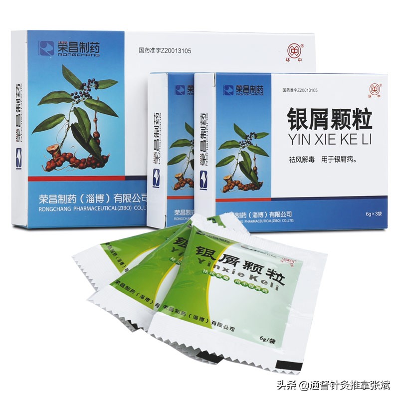 牛皮癣中成药哪种好,牛皮癣中药治疗案例