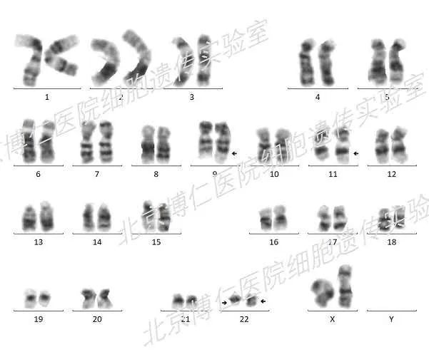 靶向药没有效果重新做基因检测,靶向治疗第二次没有基因突变