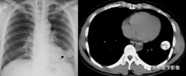 肺部基础免疫,肺基础疾病有哪些