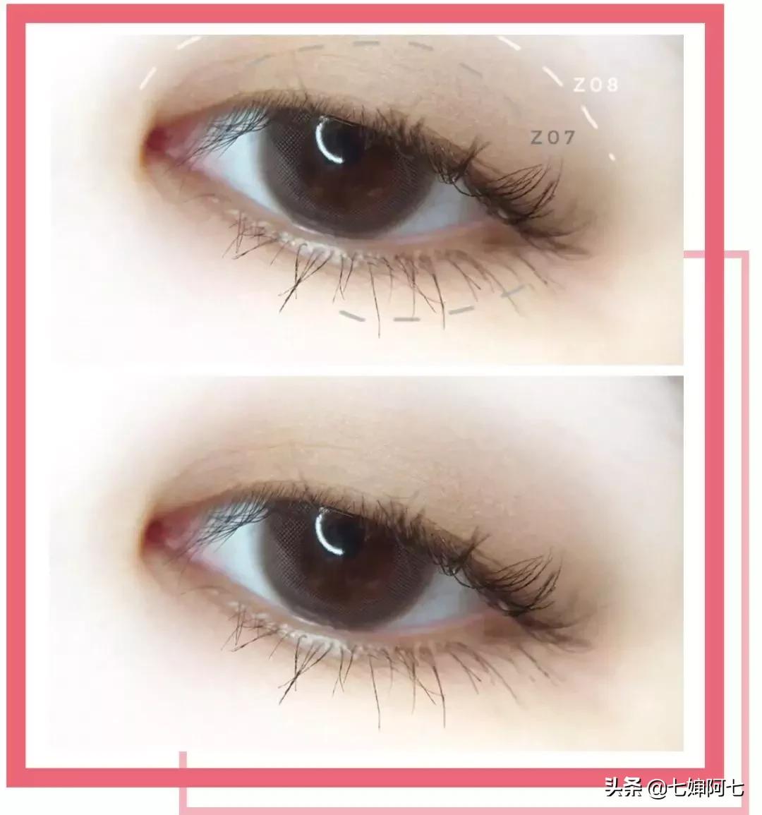 快速消肿肿眼泡,快速拯救眼睛黑眼圈