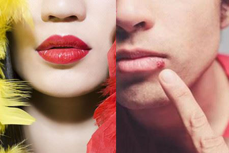 老年人嘴角烂是什么原因,小孩子嘴角烂是什么原因