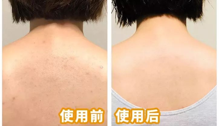 何穗美白淡斑霜,何穗竟比范冰冰还肤白