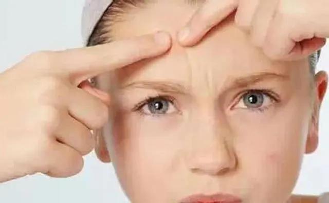 名门泽佳正确涂抹方法,名门泽佳品牌真的能去斑吗