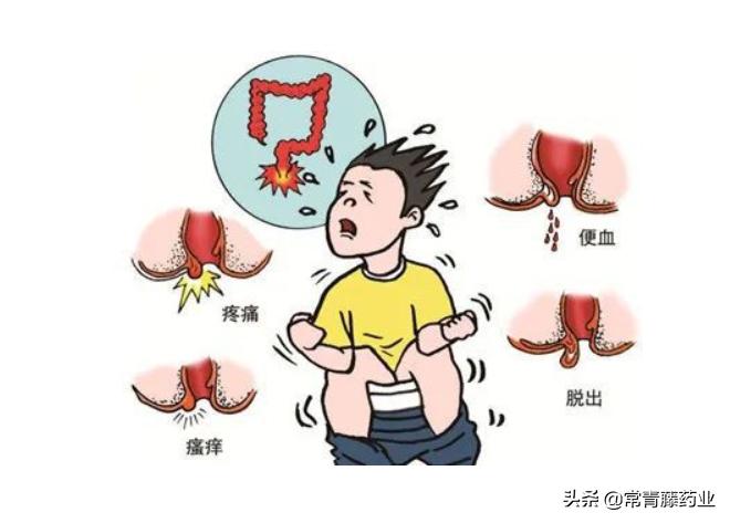 肛门直肠脓肿怎么治疗,直肠肛周脓肿治疗方法