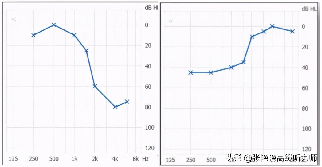 只有听不见听不清才需要重视吗？小心，听力太好也可能不是件好事