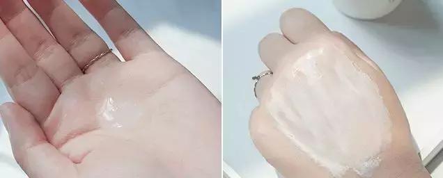 红血丝的原因你找到了吗,全面了解红血丝超全知识版