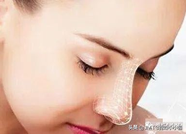鼻子怎么修复好看呢,鼻型修复方法大全