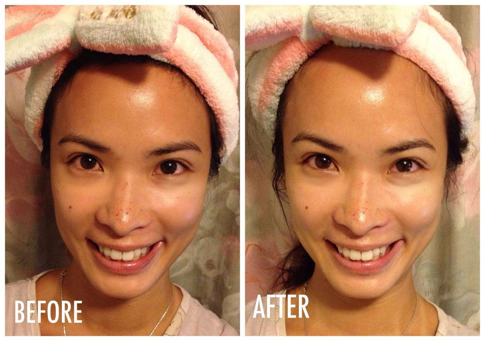 蜂蜜和开塞露搭配有什么效果,开塞露和蜂蜜去除斑点