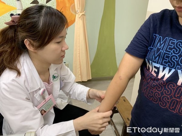 异位性皮肤炎遇到夏天怎么办？流汗一定要擦干也要做保湿