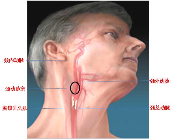 一个吻痕引起的致命性脑梗死事件，医生为你图说其中的机制