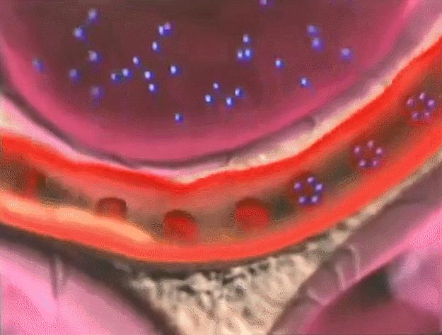 脑功能成像和血管成像,核磁共振脑成像mra是查什么的