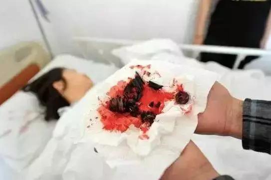 轻轻一坐,屁股炸得血肉模糊!年年有人被椅子炸飞,赶紧自查