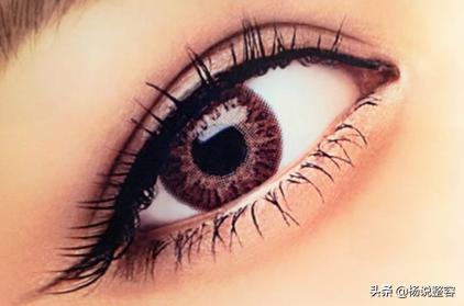 埋线双眼皮是什么原理,双眼皮埋线优缺点