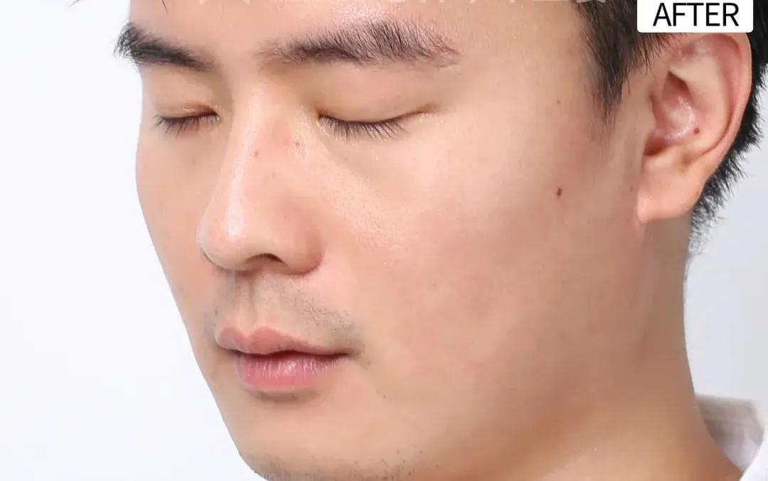 效果最好的熬夜面膜,去闭口熬夜最适合用的面膜