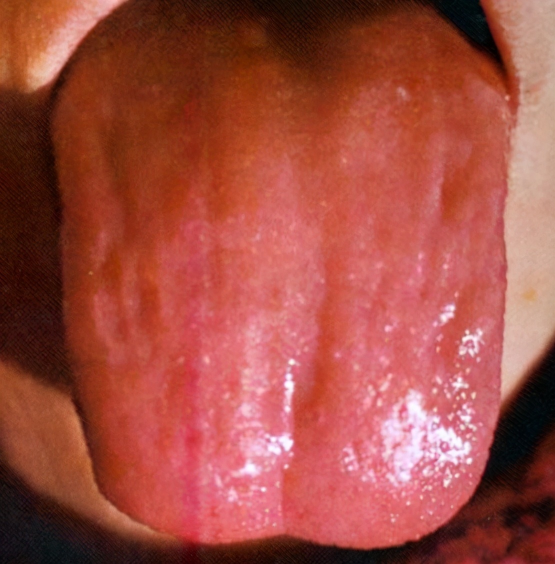 对阴阳的感悟,阴虚的至简辨证